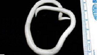 ascaris An adult Ascaris lumbriocoides worm.